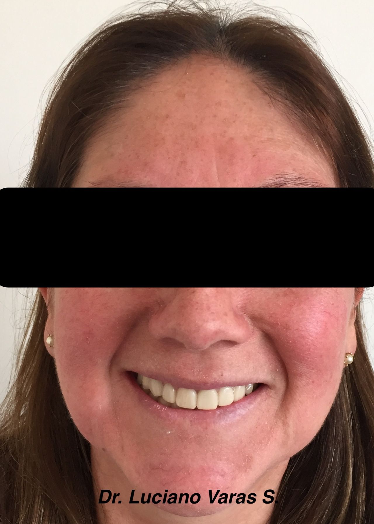 Luciano Varas Salinas-1