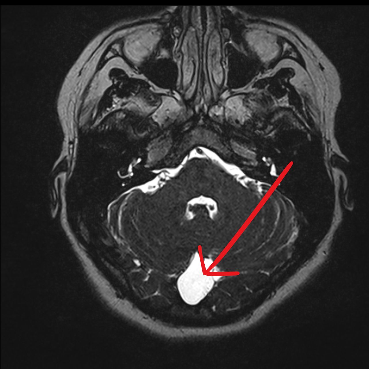 David Tafur Muñoz-1429