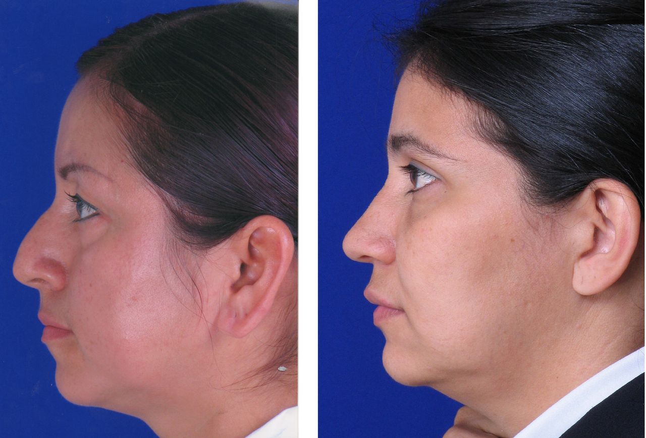 Jorge A Holguin Ruiz-15