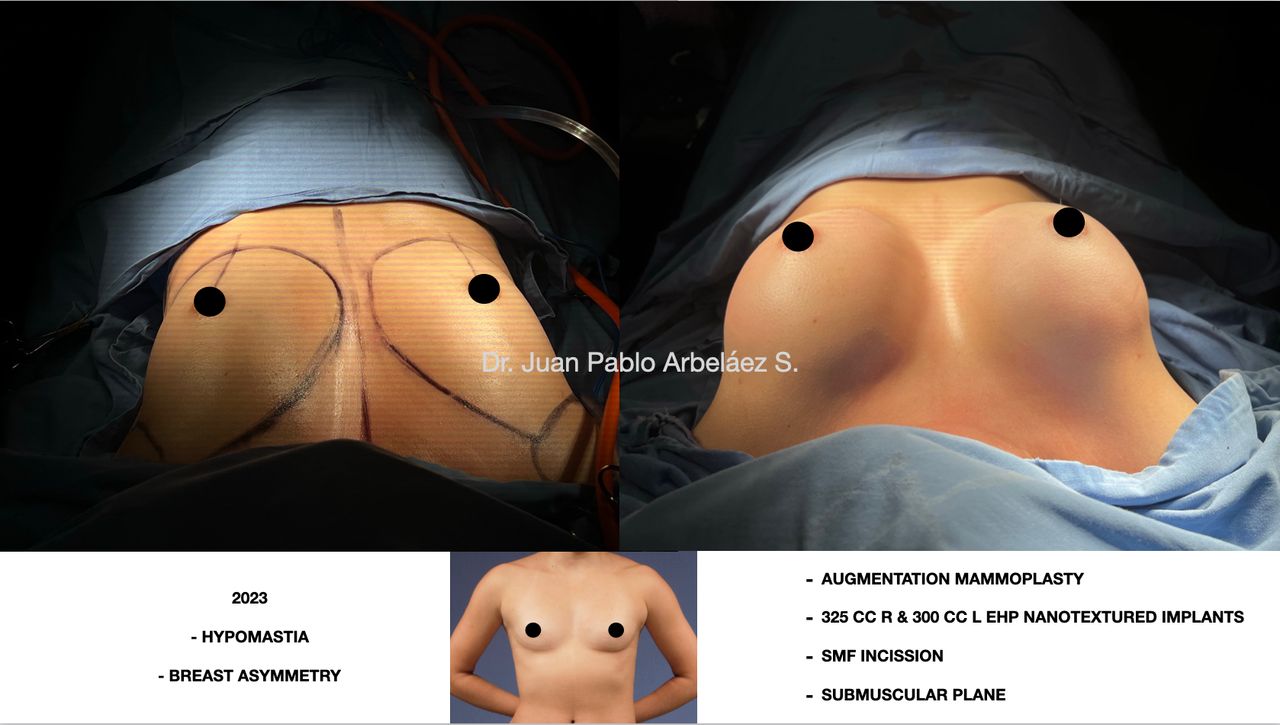 Juan Pablo Arbeláez Sierra-43