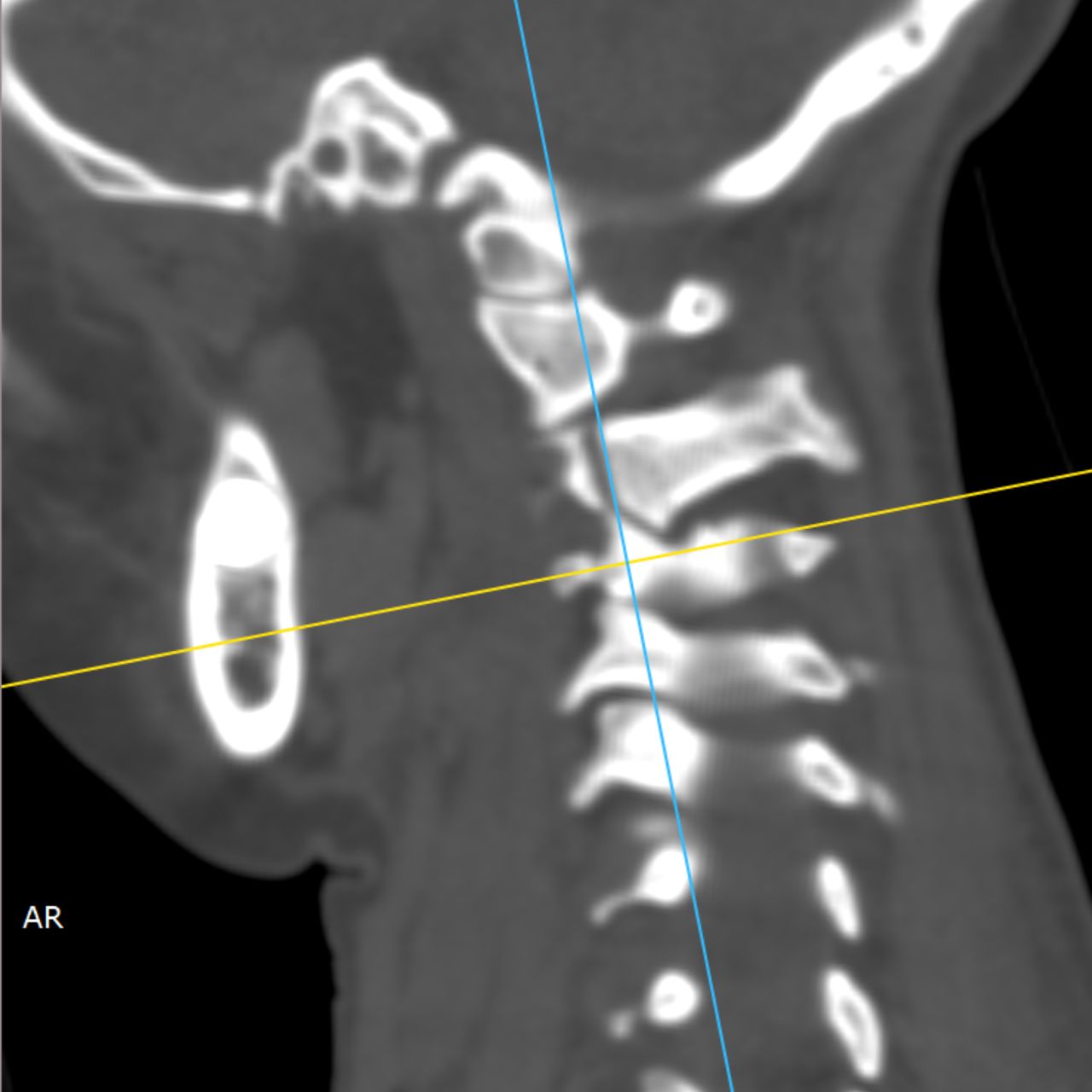 David Tafur Muñoz-2113