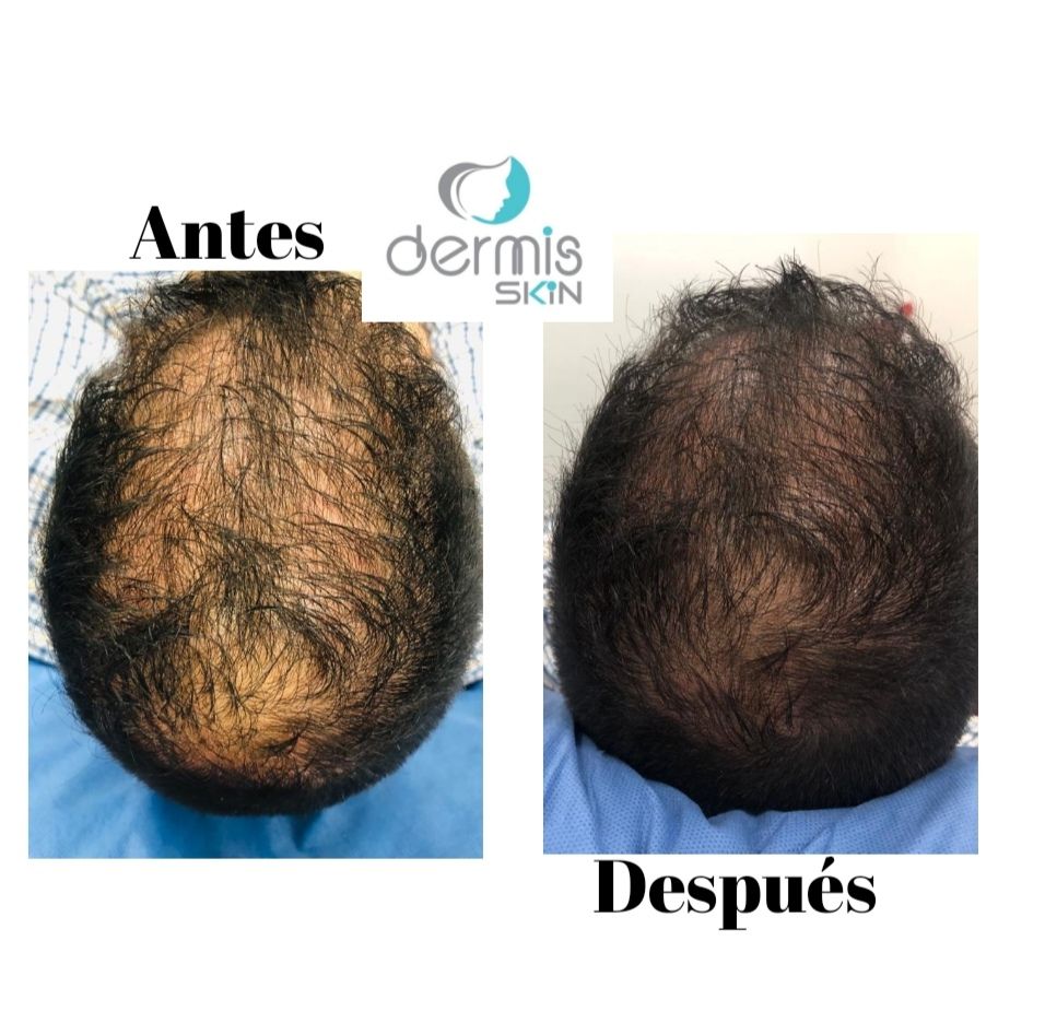 Carlos Alberto Ceron Gomez-7