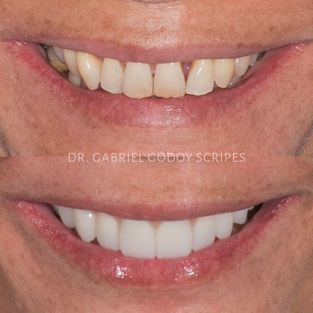 Gabriel Godoy Scripes-13