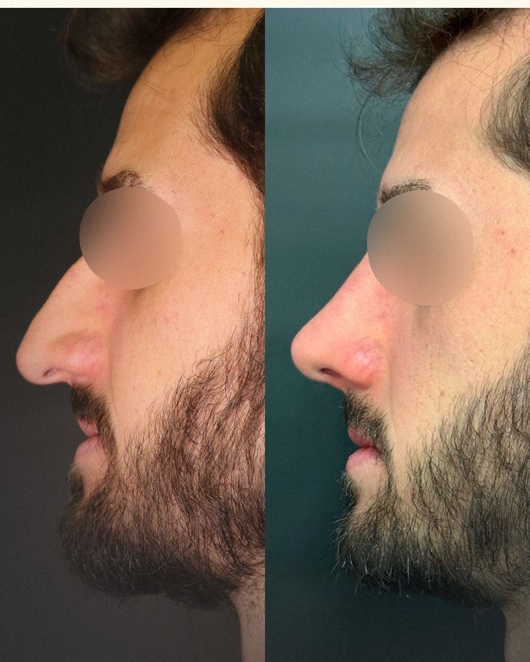 Hugo Cardoso De Oliveira-10