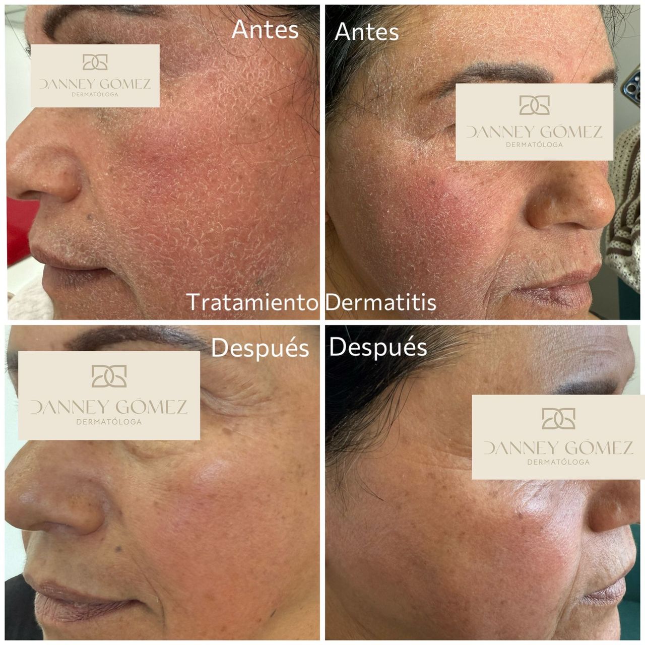 Danney Gomez Angulo-4