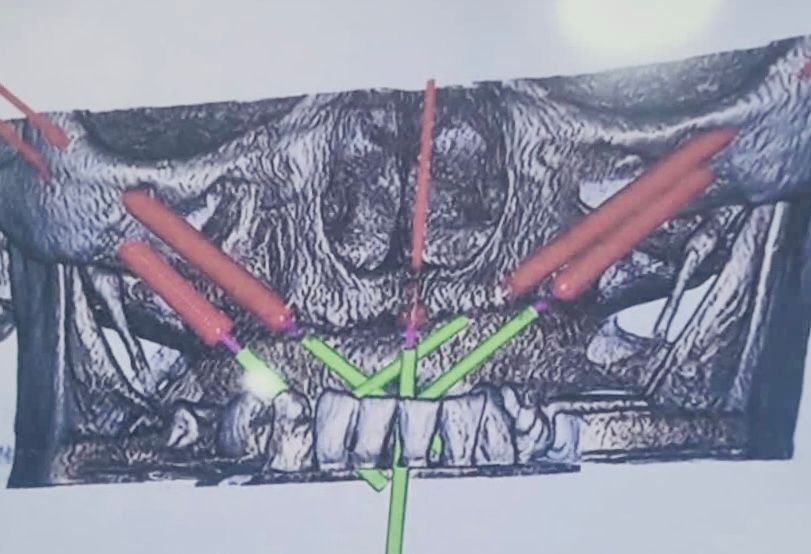 Jose Vicente Rocha Fernandez-11