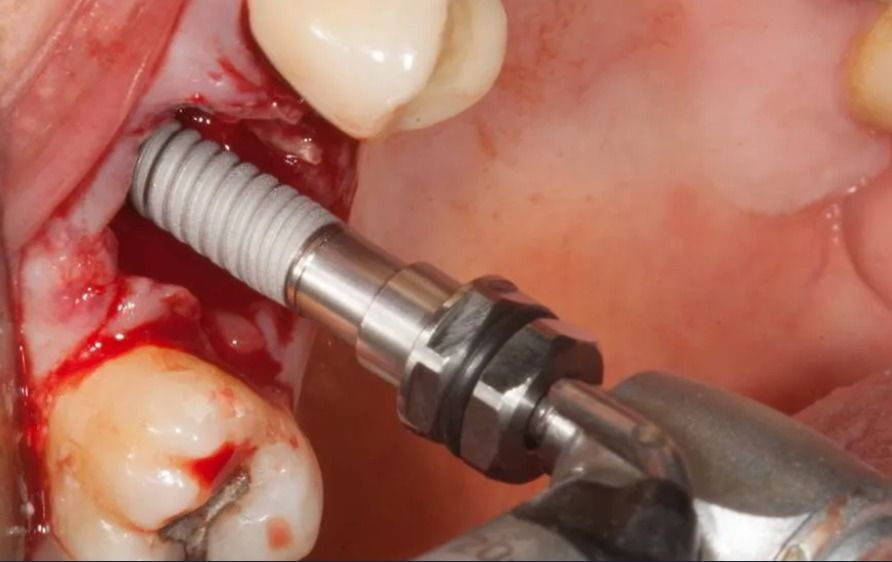 Joel Anderson Valverde Rebaza-10