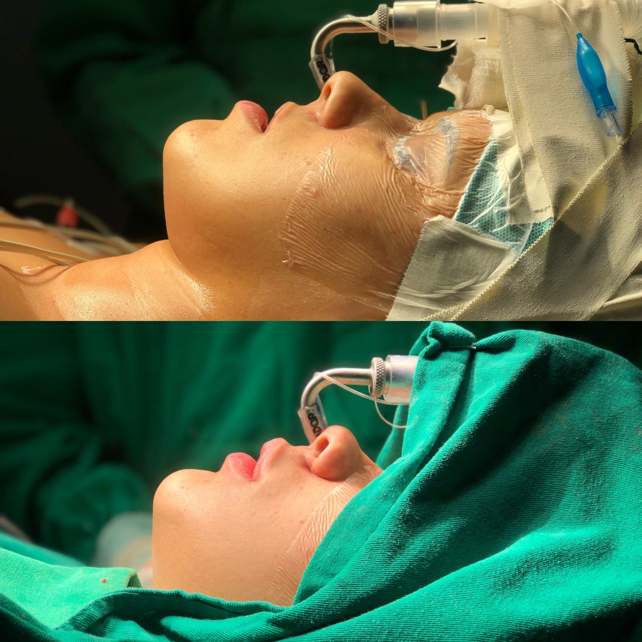 Raffael Maron Vieira De Noronha-30