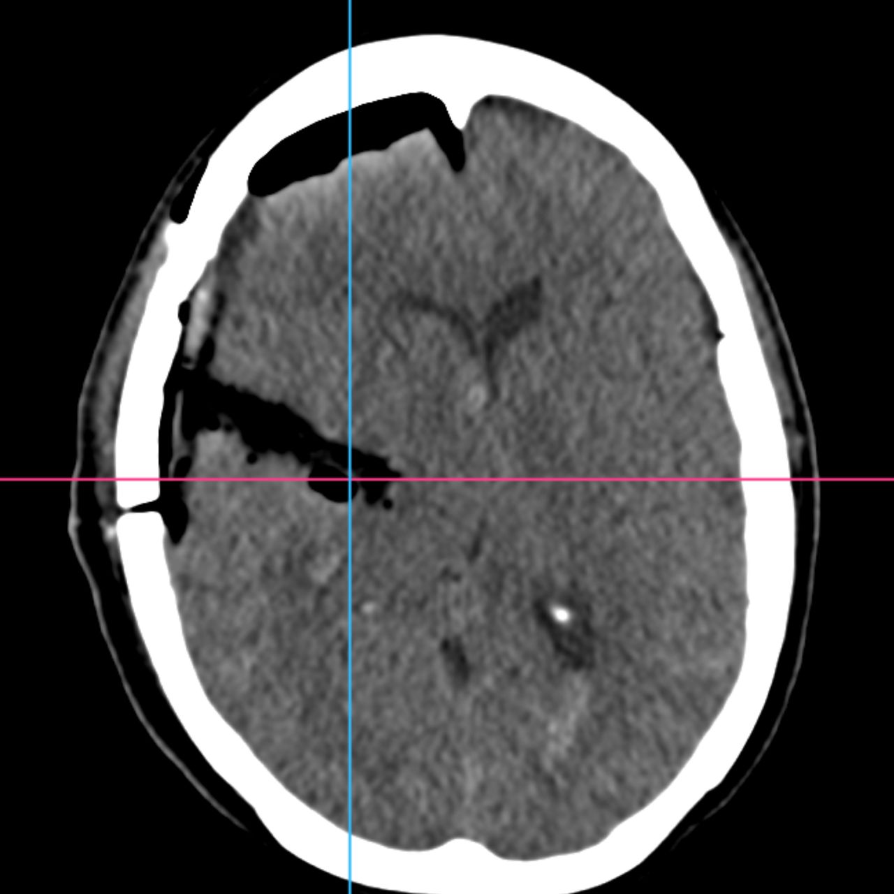 David Tafur Muñoz-2030