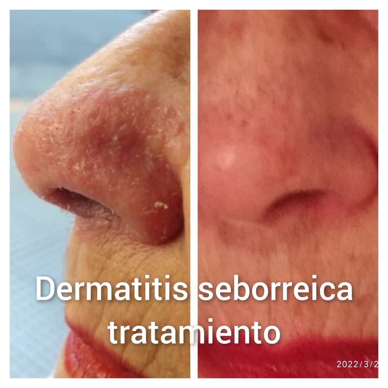 Alejandra Meijide-14