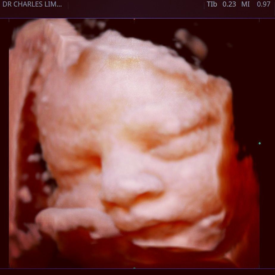 Charles Schwantz De Lima-29