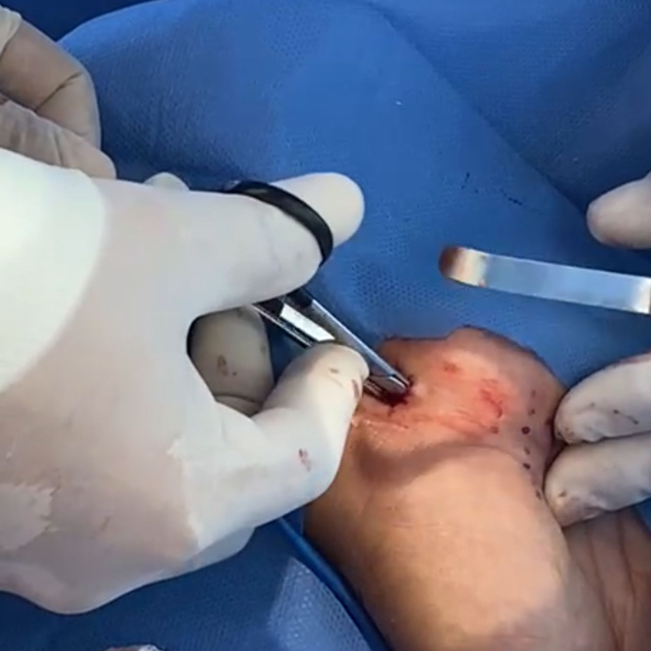 David Tafur Muñoz-1259