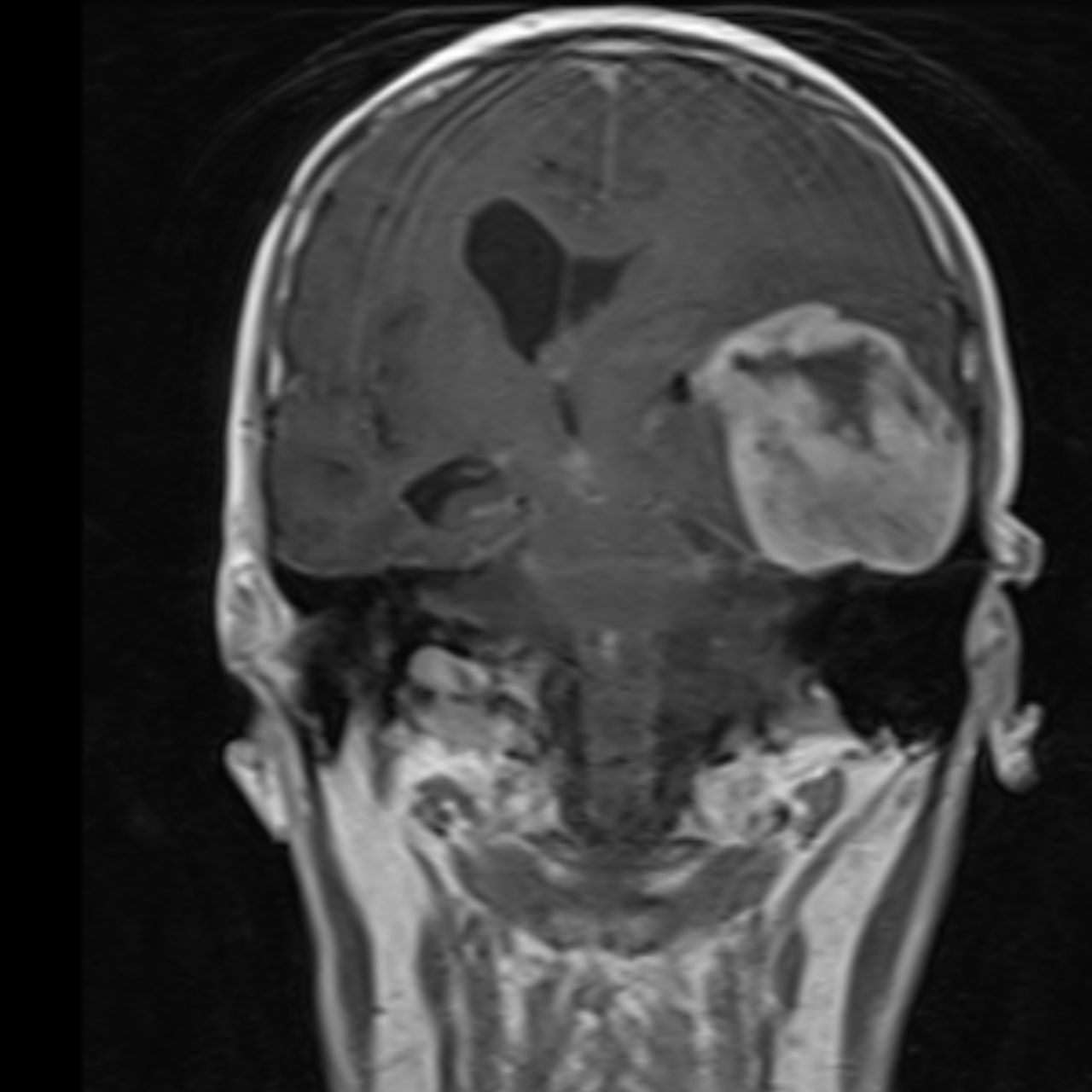 David Tafur Muñoz-1818