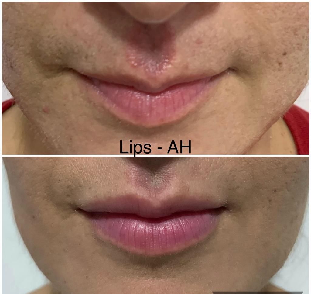 Maria Gisela Angel Losada-54