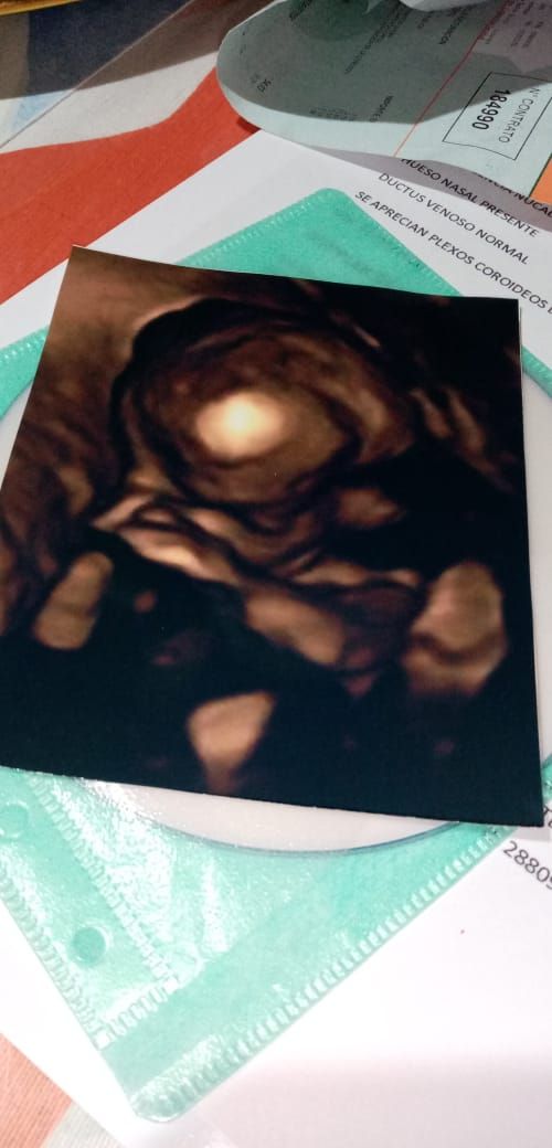 María Denisse Alvarez Huanca-3