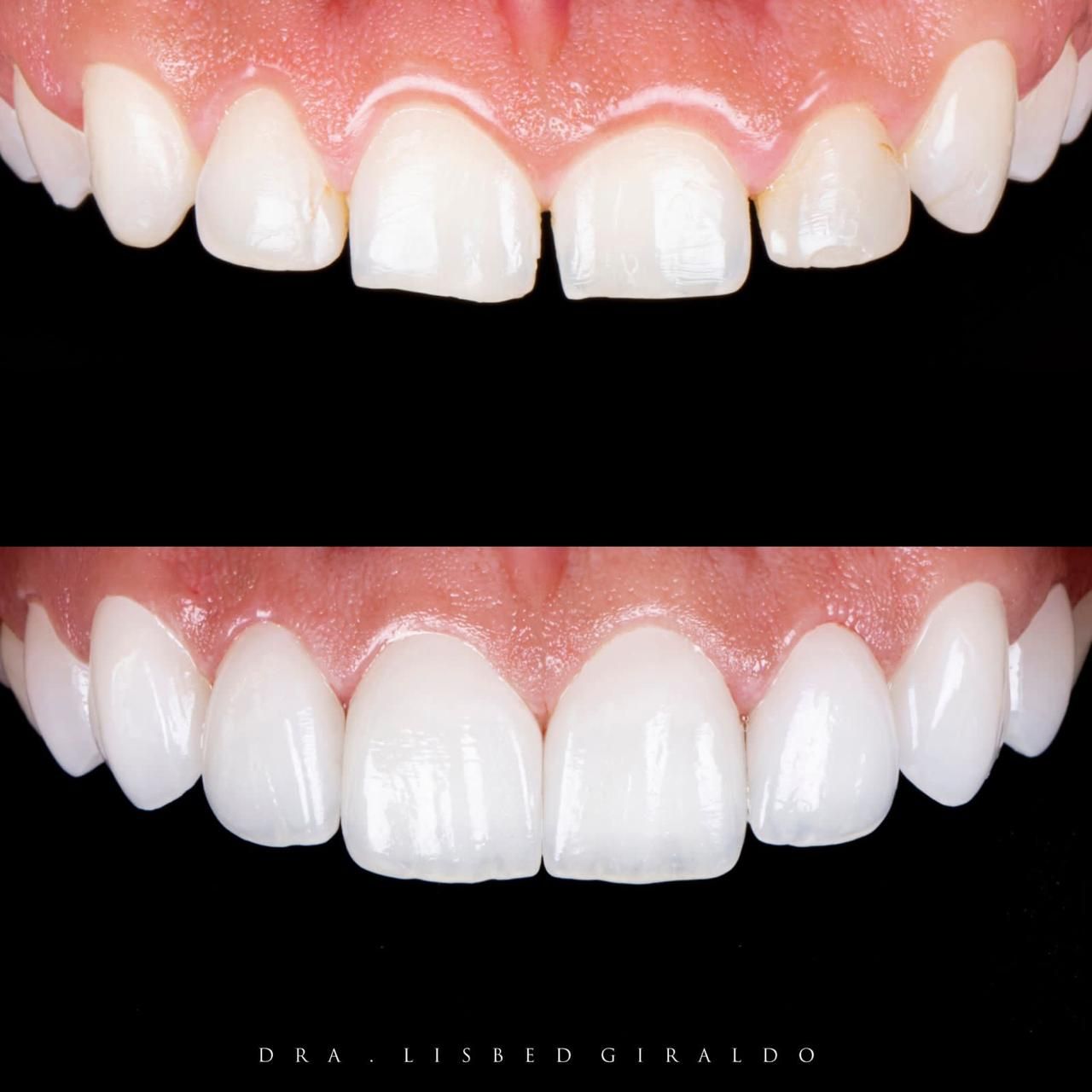 Lisbed Giraldo Olarte-42