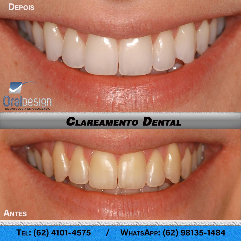 Danilo Monteiro Rezende Pereira-21