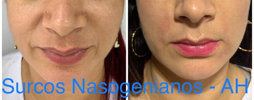 Maria Gisela Angel Losada-51