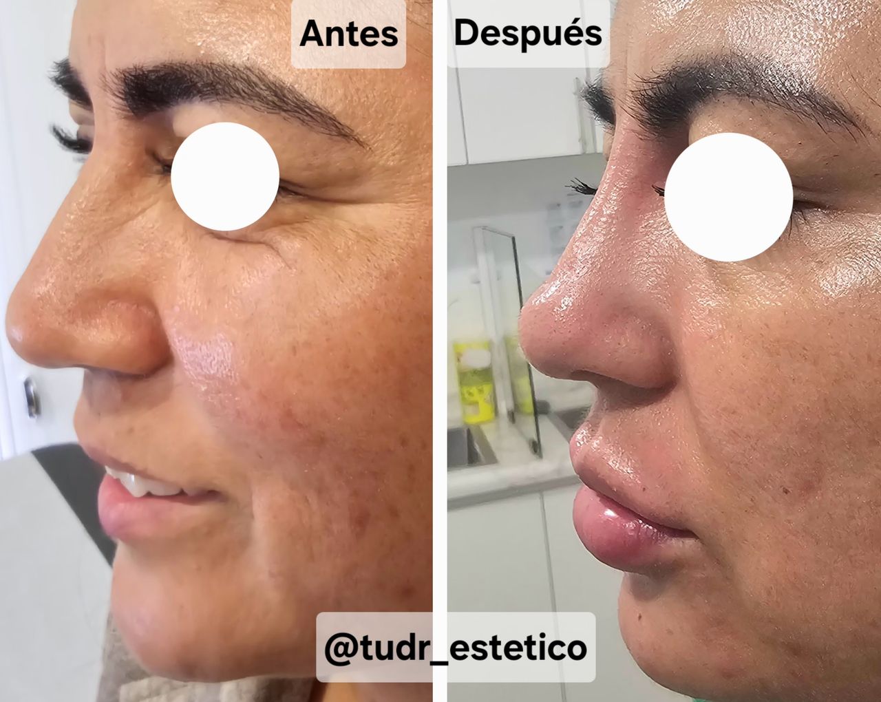 Diego Indriago Arias-16