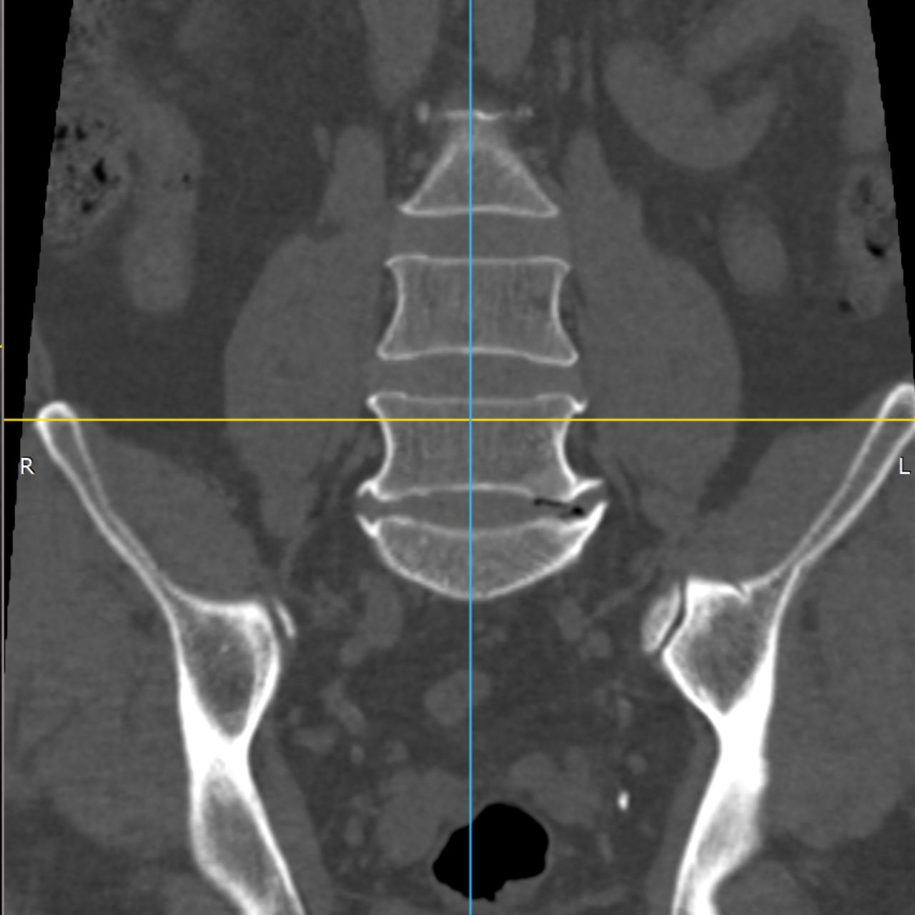David Tafur Muñoz-1795
