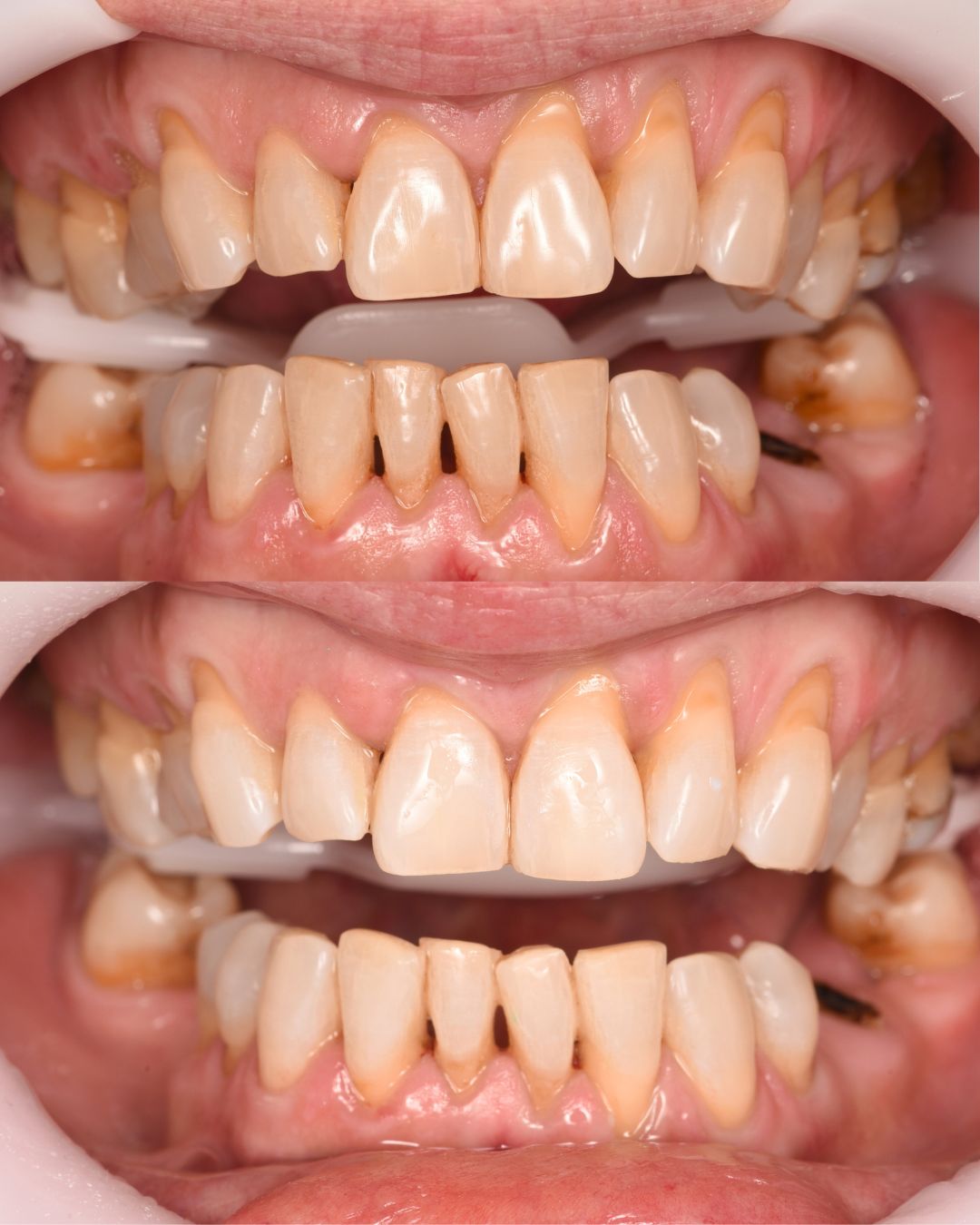 Andrés Verdugo Bolumburu-4