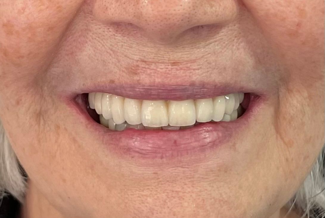 Luciano Varas Salinas-45