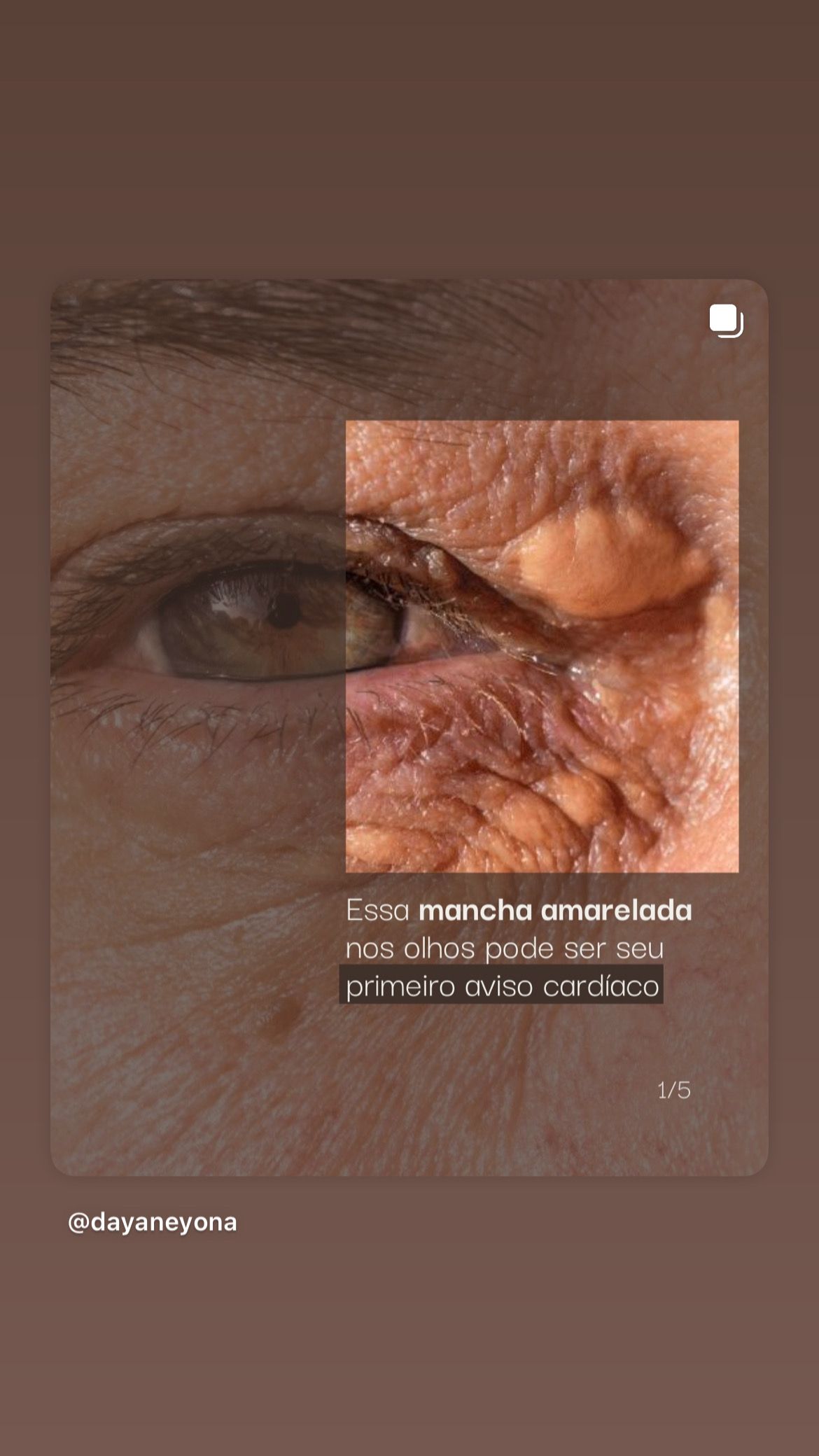 Dayse Hellen Teles Barroso-13