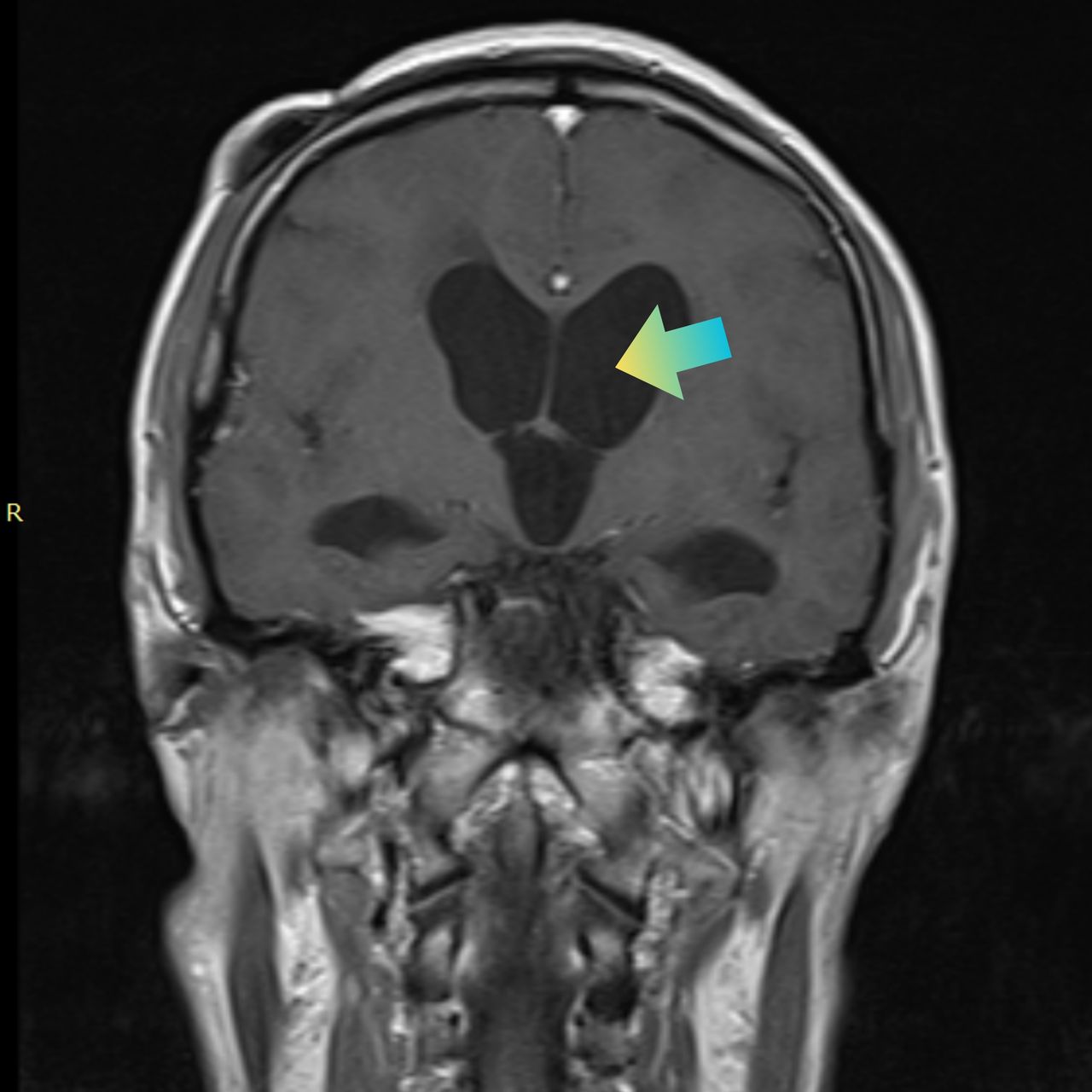 David Tafur Muñoz-2404