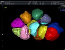 Diego Giovanni Rubiano Zarate-22