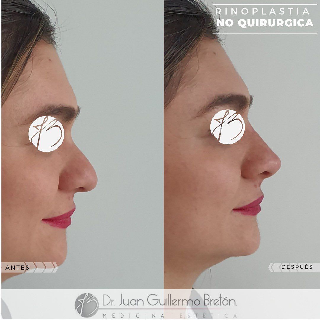 Juan Guillermo Bretón Franco-14