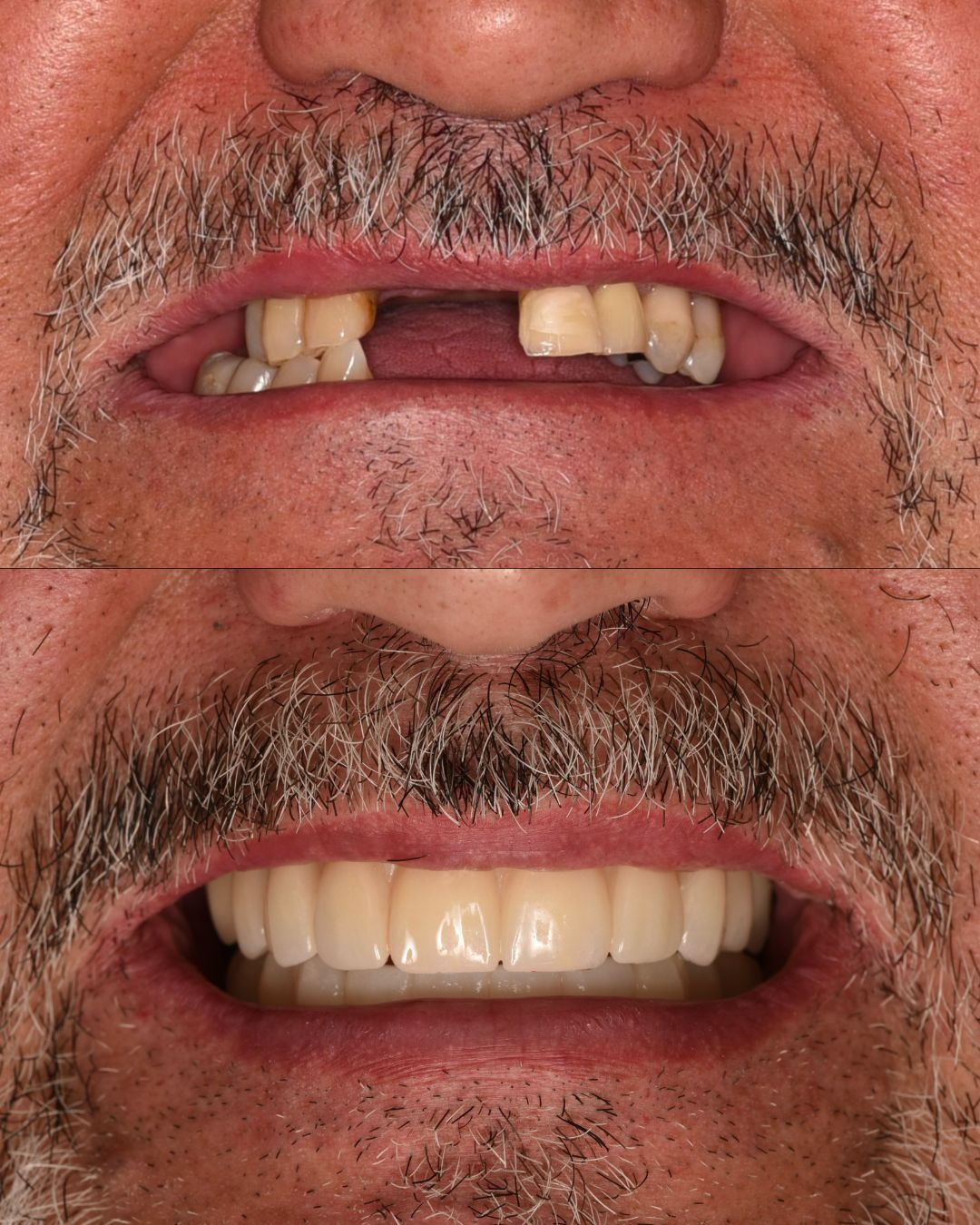 Andrés Verdugo Bolumburu-0