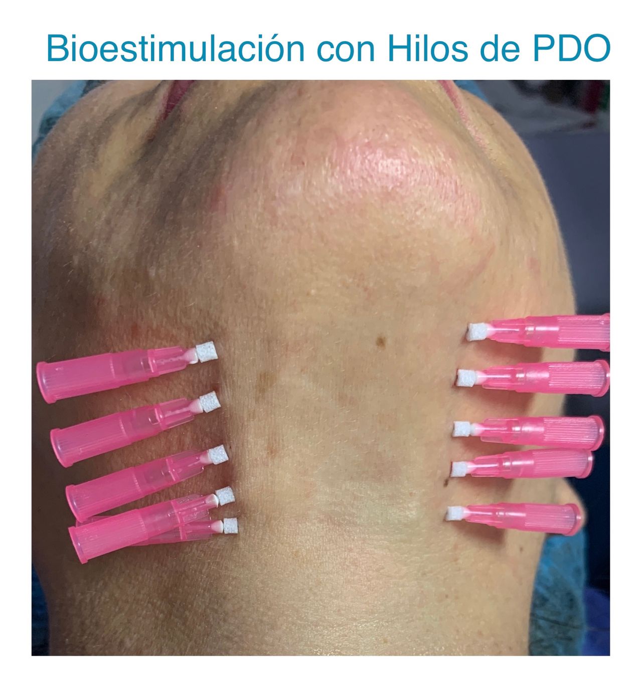 Maria Gisela Angel Losada-18