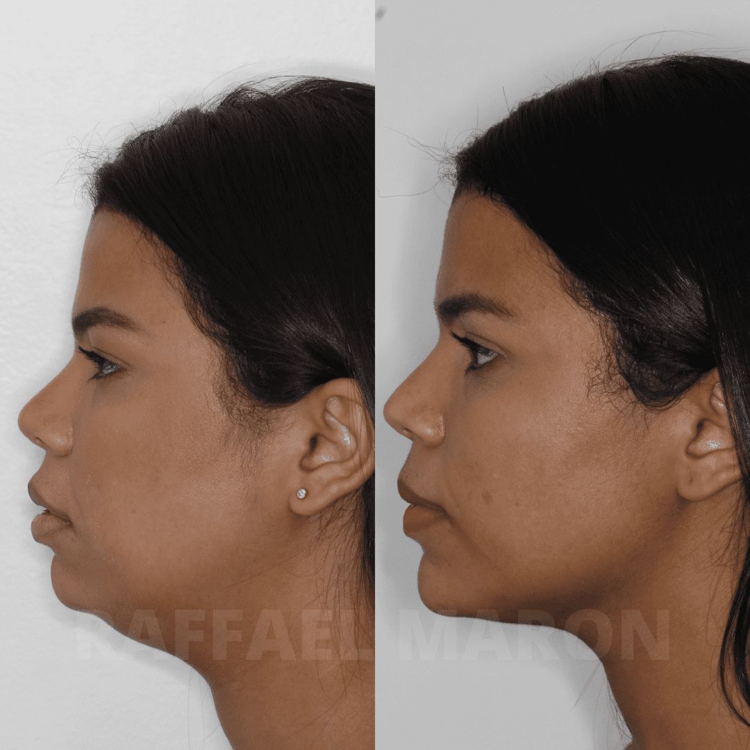 Raffael Maron Vieira De Noronha-7