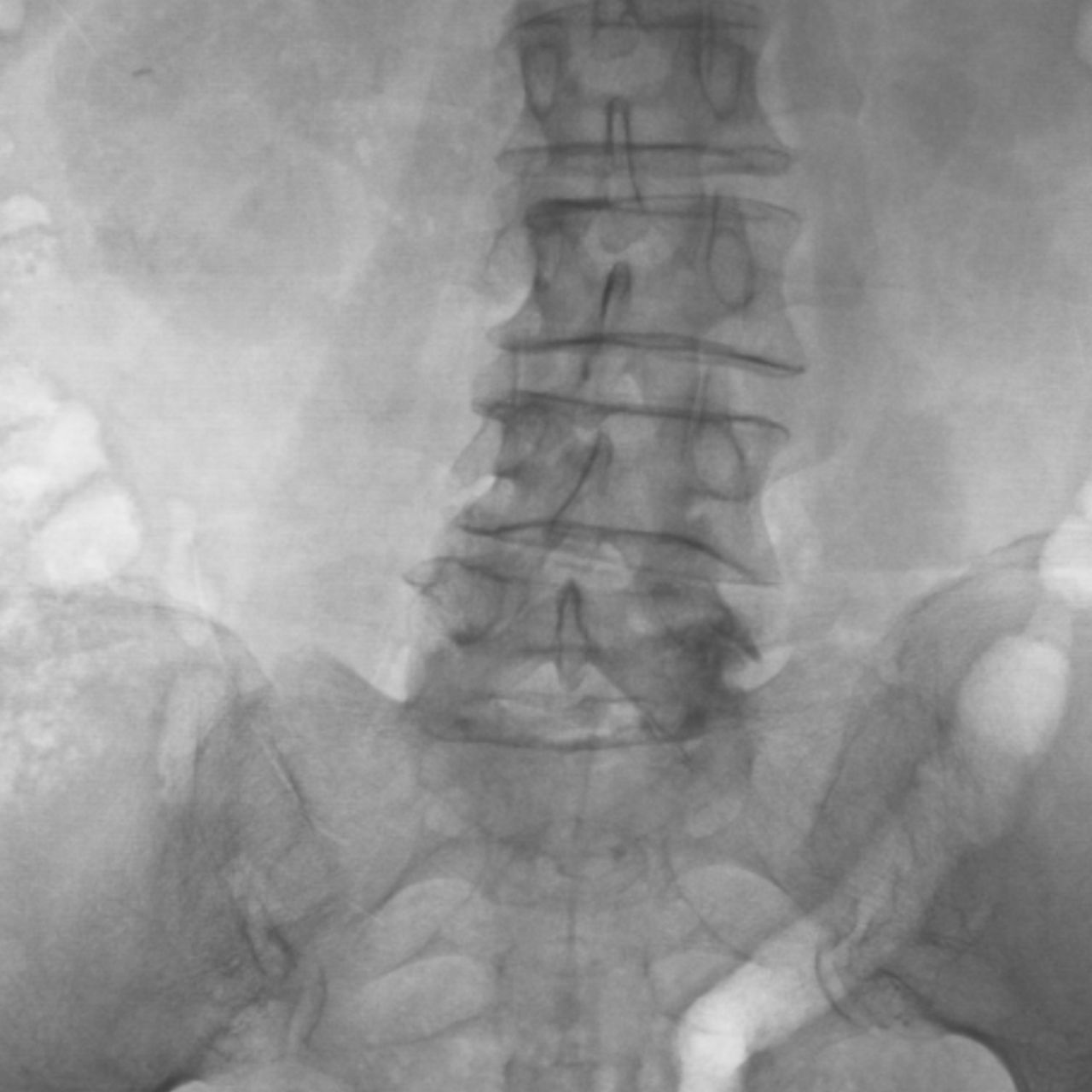 David Tafur Muñoz-1557