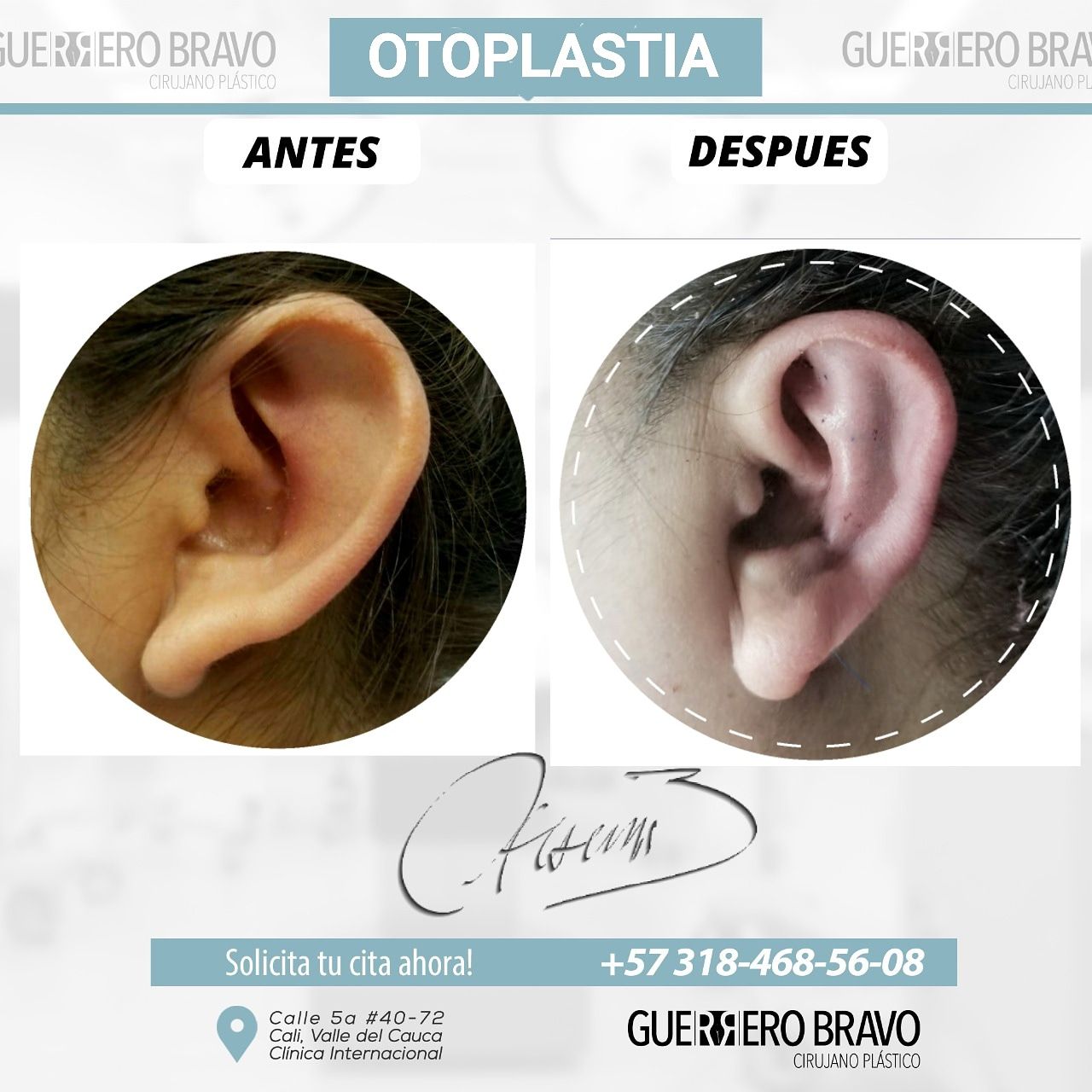 Camilo Guerrero Bravo-65