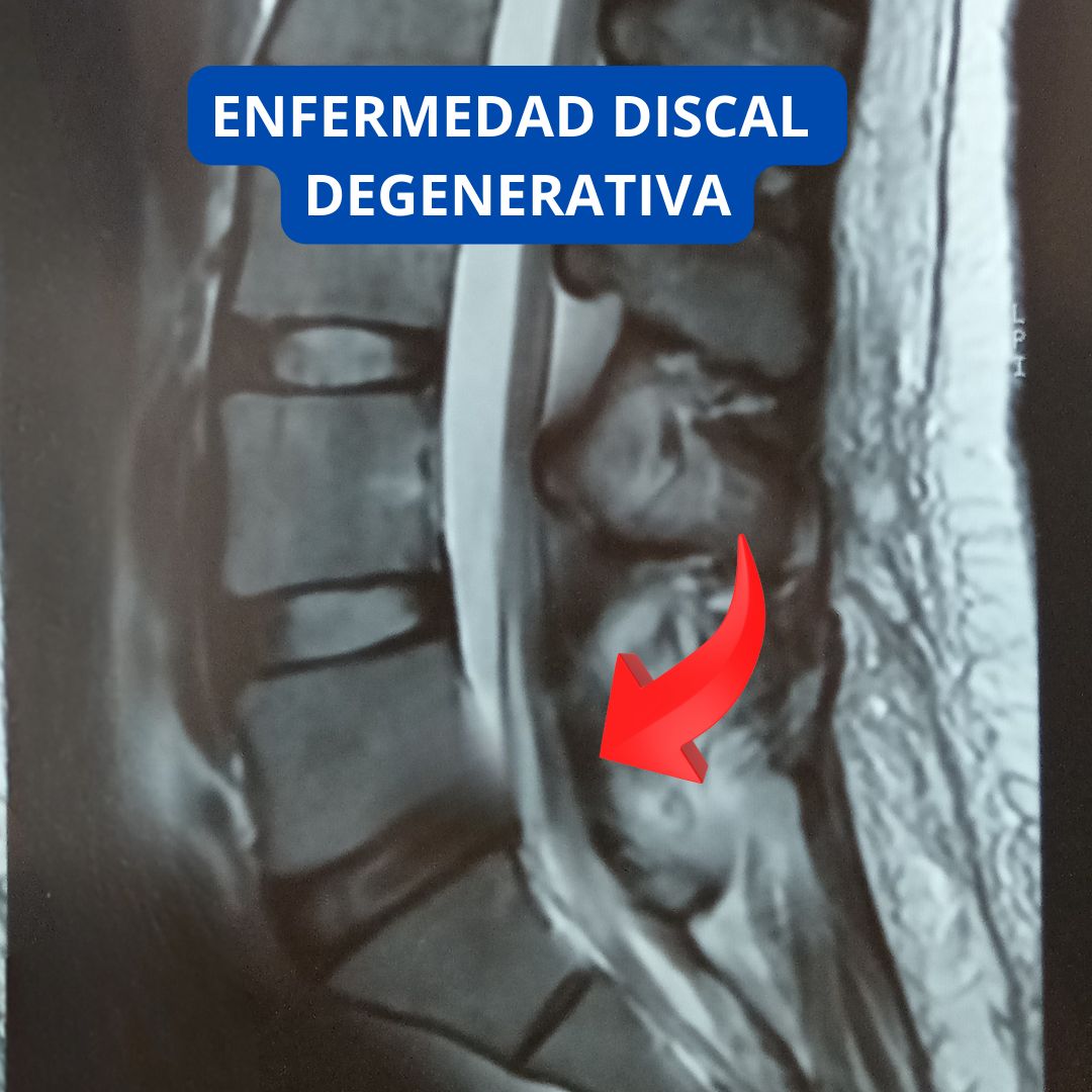 David Tafur Muñoz-2140