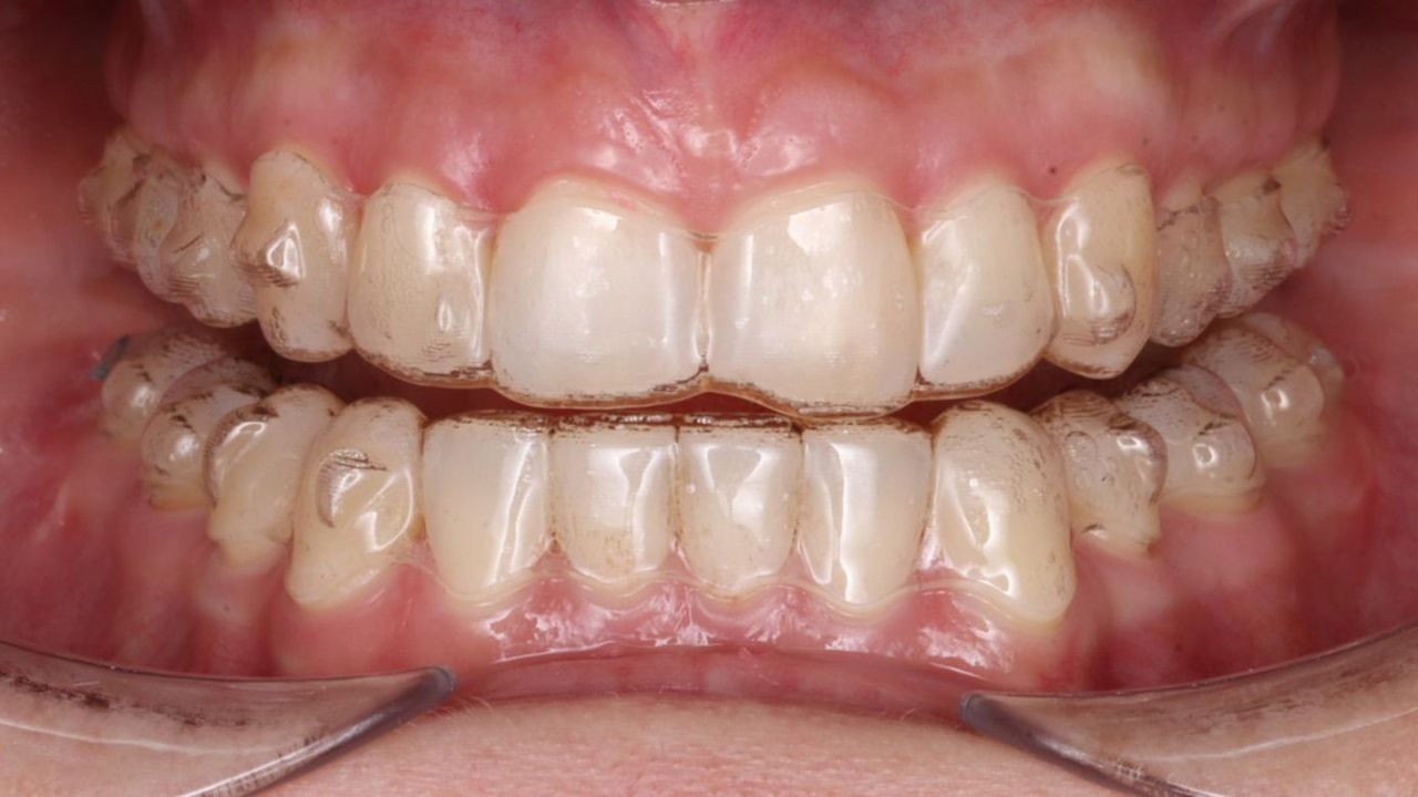 Rodrigo Hodar Dinamarca-6