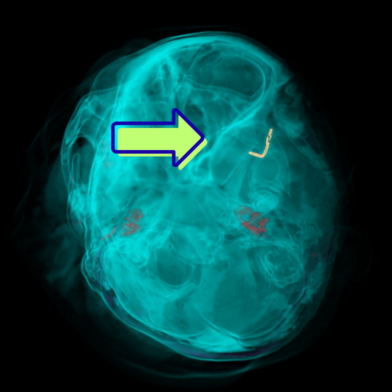 David Tafur Muñoz-1748