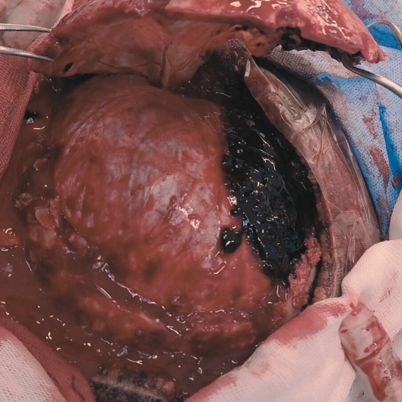 David Tafur Muñoz-1392