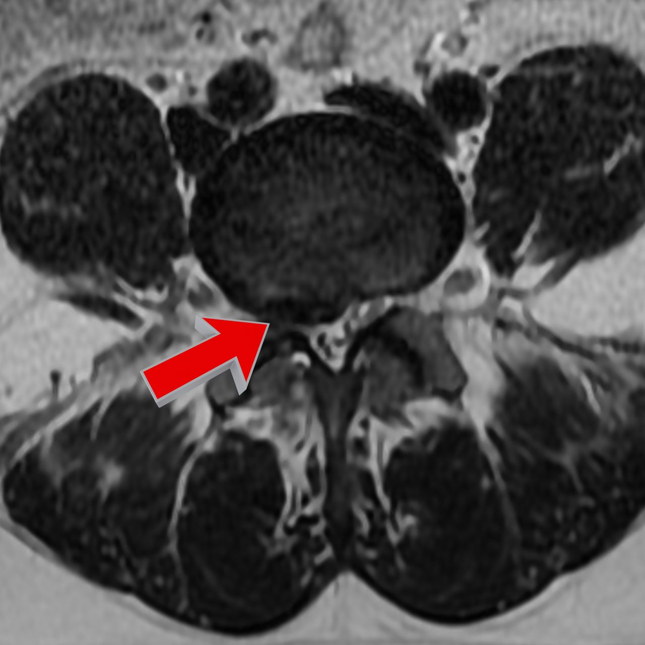 David Tafur Muñoz-2192