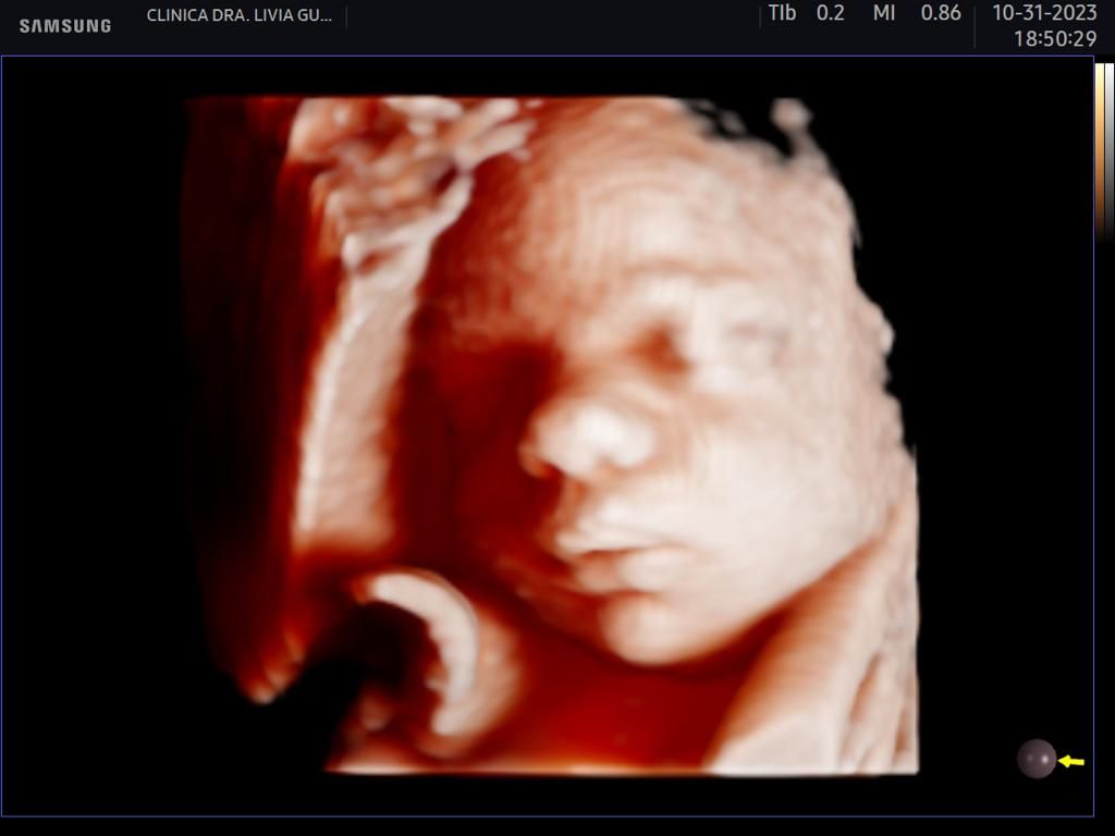 Livia Campelo Guerra Ribeiro-0