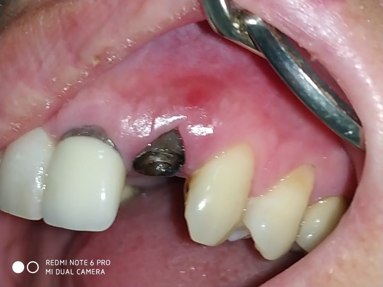 Pablo B. Azcárate-7