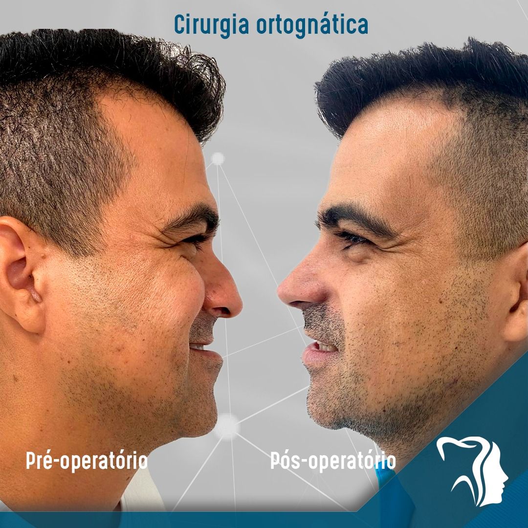 Carlos Alysson Aragão-28