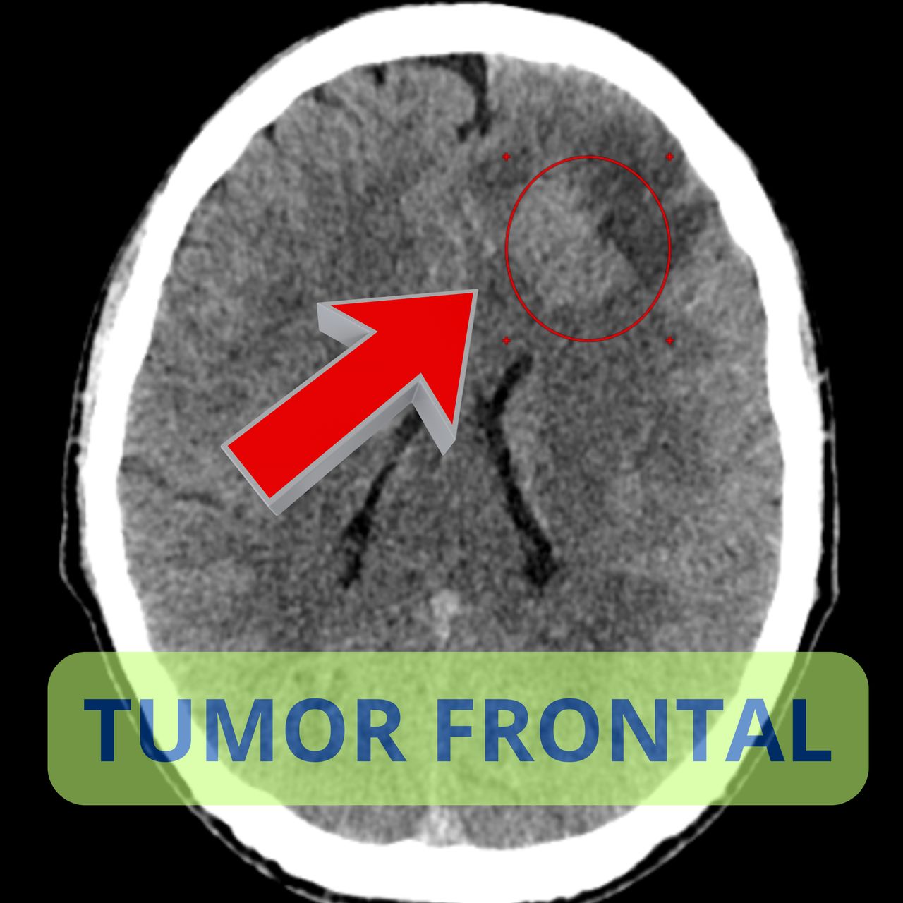 David Tafur Muñoz-2167
