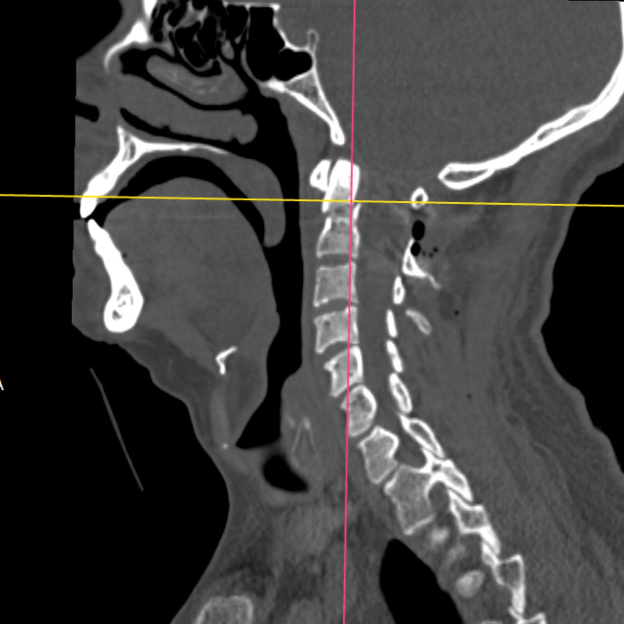 David Tafur Muñoz-1791