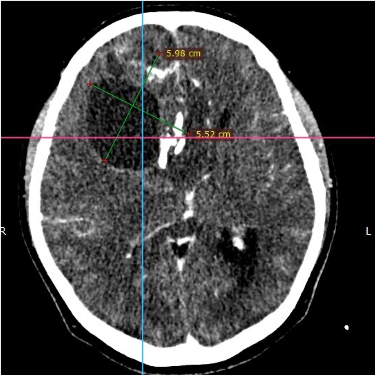 David Tafur Muñoz-1343