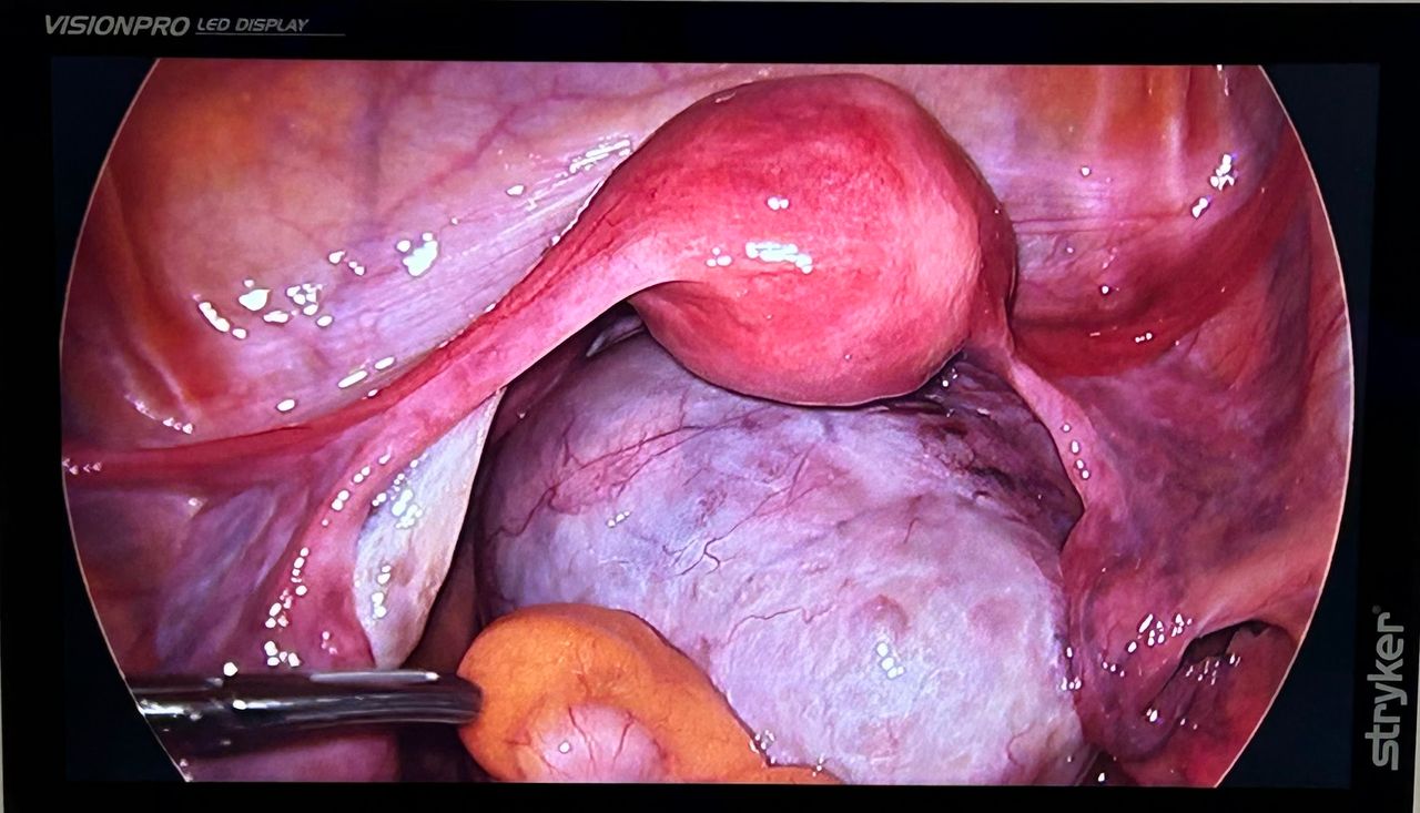 Adalberto Cesario Pereira Junior-22