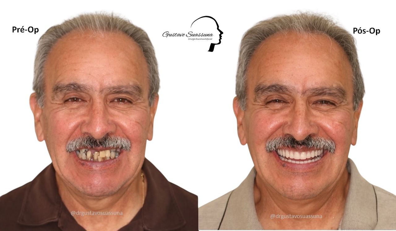 Gustavo Suassuna-1
