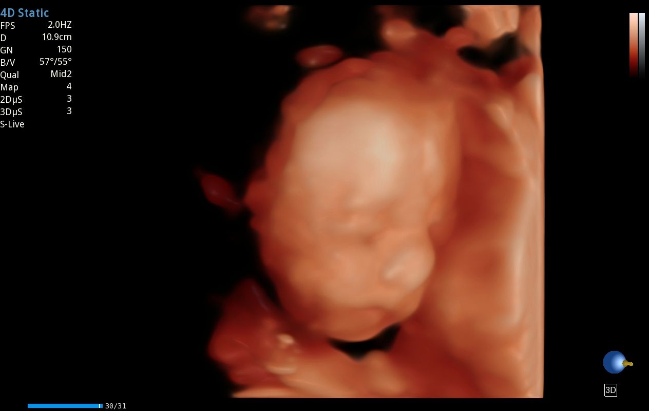 Armando Efren Fong Lei-5