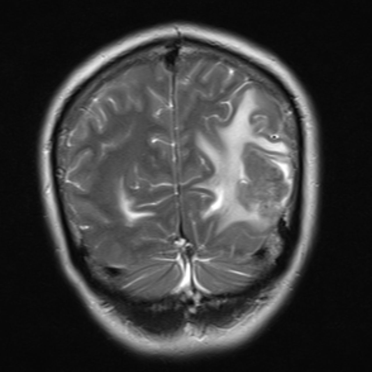 David Tafur Muñoz-1821